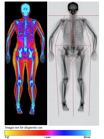 bodyscan.png